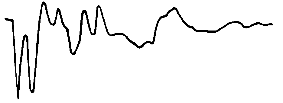 無遠端短路環波形 無遠端短路環波形